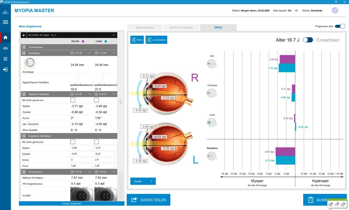 MYOPIA MASTER®by OCULUS - ParagonCare